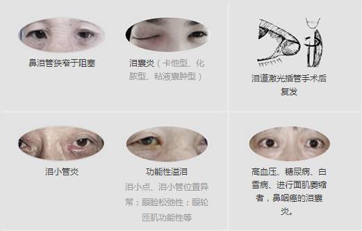 12月17日，普瑞集團(tuán)淚道專(zhuān)家來(lái)疆親診，預(yù)約請(qǐng)速！